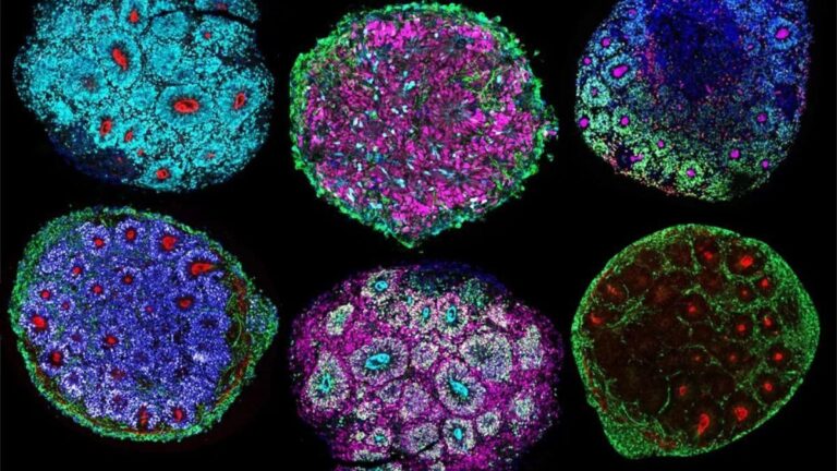 Lee más sobre el artículo Organoides: una nueva frontera científica para la investigación pediátrica